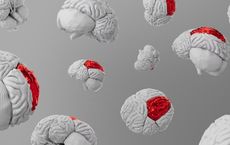 Article Image for Neurological Wearables for Concussion Detection in Contact Sports