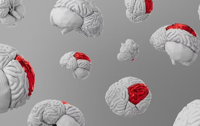 Article Image for Neurological Wearables for Concussion Detection in Contact Sports
